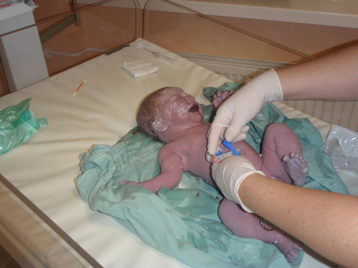 rajce.idnes.cz baby. 1 